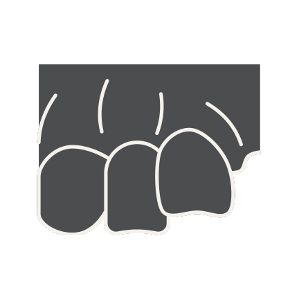 Description of Image