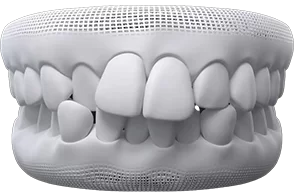 Description of Image