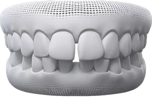 Description of Image