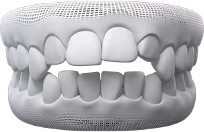 Description of Image