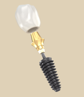 dental implant everysmile dental implant everysmile