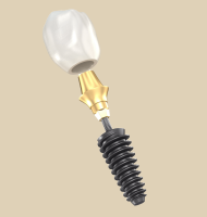 dental implant everysmile dental implant everysmile