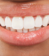 i would like to-whiten my teeth i would like to-whiten my teeth