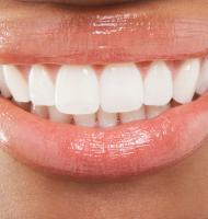 i would like to-whiten my teeth i would like to-whiten my teeth